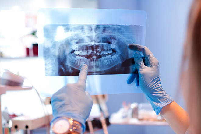 Dental X-rays Chicago